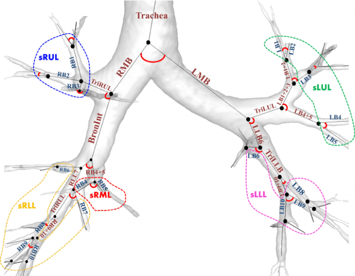 Label the large airway segments indicated in the figure